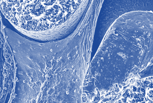 Osteoconductive