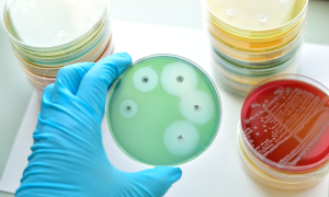 Different dishes with substances showing the possible evaluation of antimicrobial efficacy