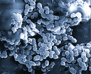 antimicrobial effectiveness, dental products