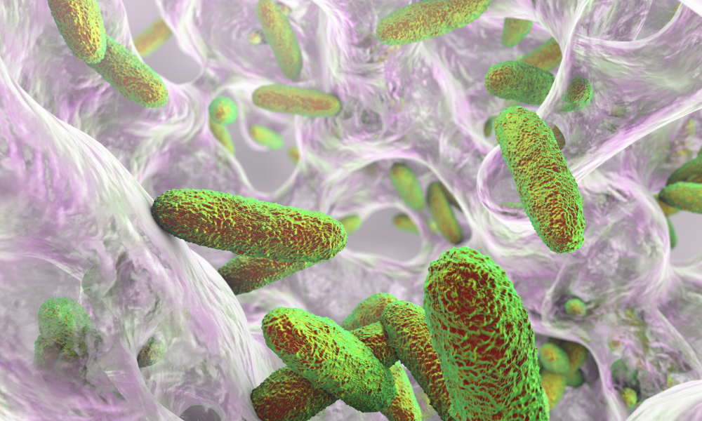 iFyber Biofilm Testing The Critical Step in Advancing Infection-Resistant Medical Devices