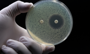 iFyber Blog Biofilm Disruptors in Wound Care Products: Moving Beyond Antimicrobials