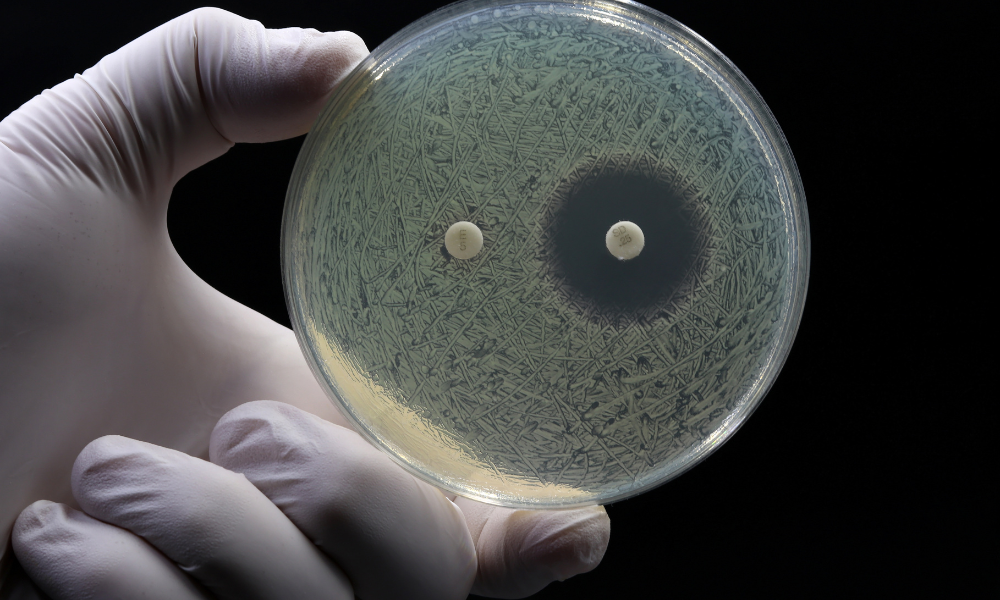 iFyber Blog Biofilm Disruptors in Wound Care Products: Moving Beyond Antimicrobials