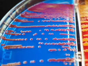 Managing Antimicrobial Resistance in Chronic Wound Care