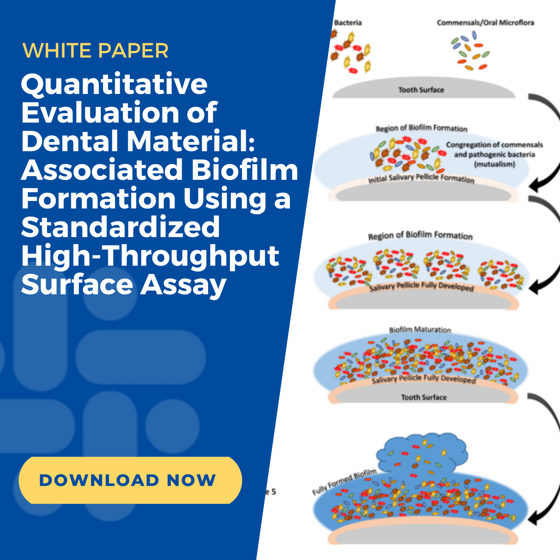 Biofilm Attachment in Dental Material